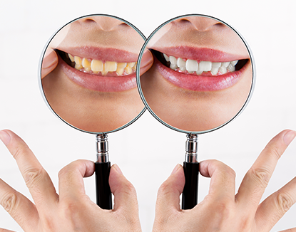 手鏡に女性の歯が映し出されている写真